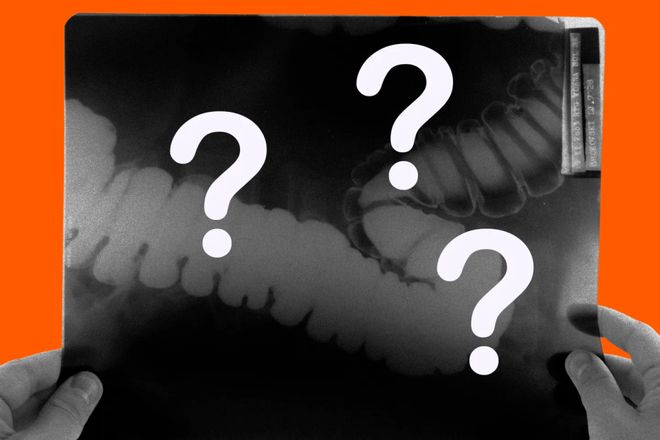 生6个月「废功」20%癌症检出率！pg模拟器试玩柳叶刀惊曝：AI让医(图2)